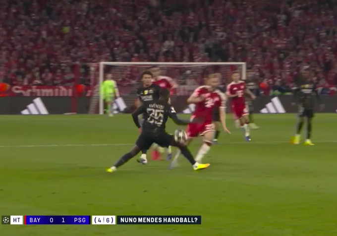 Mendes để bóng chạm tay ở tình huống phản công của Bayern